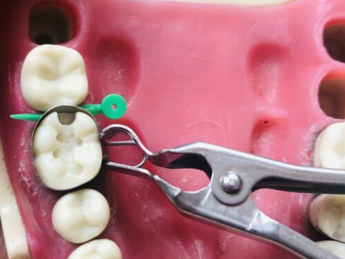 Dental Matrix Bands/ The U Dental Bands. Molars
